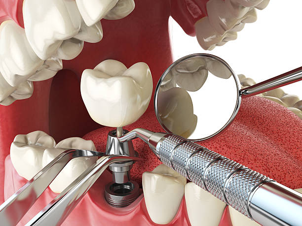 Best Emergency Orthodontic Repairs in Comstock Northwest, MI